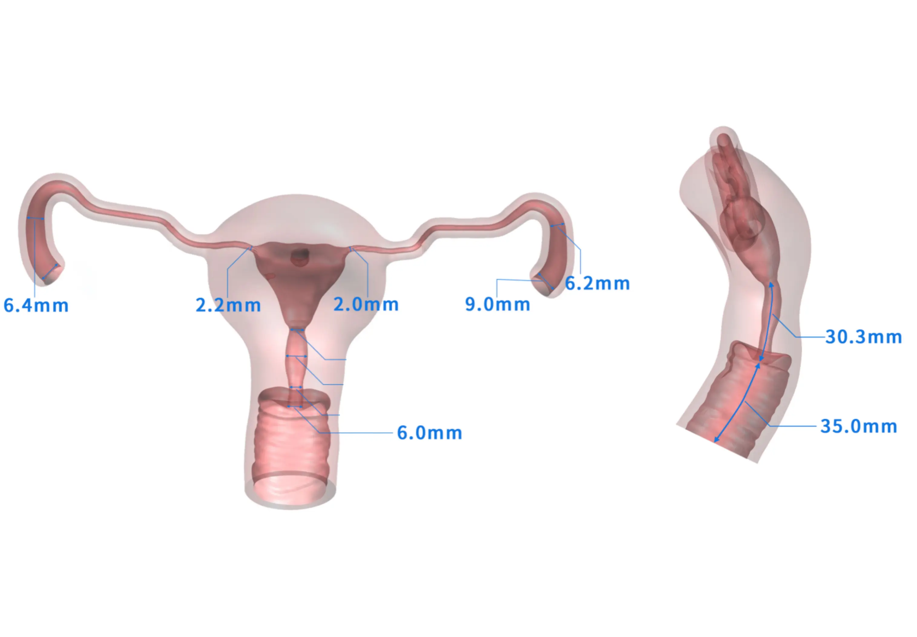 gynecological training model