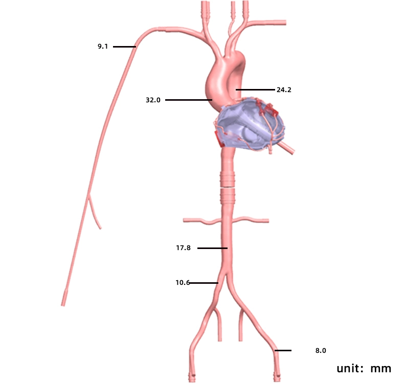 3d coronary artery model supplier