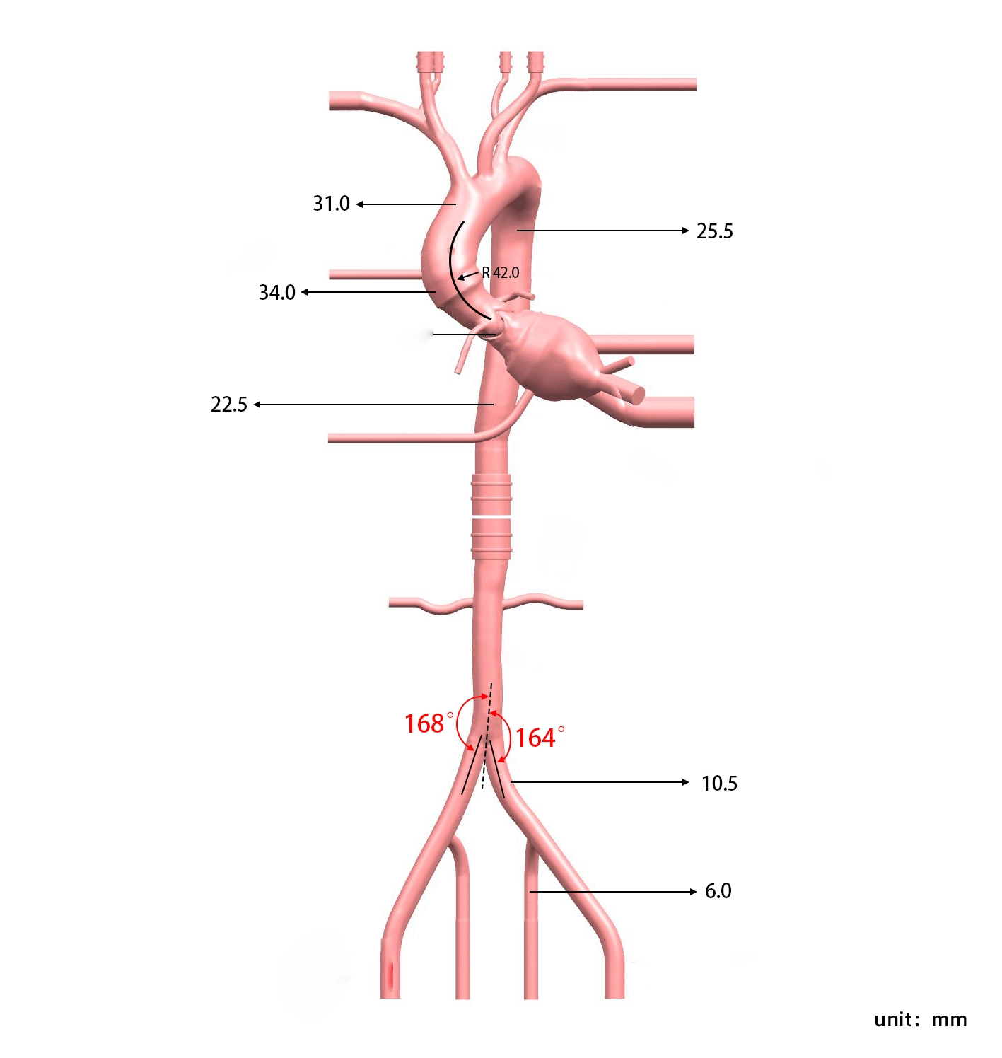 Main Dimensions of TAVR Simulation Model