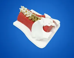 Spinal Endoscopic Trainning Model