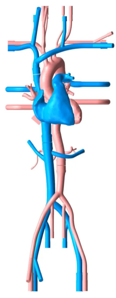 Drawing of Cardiac Training Model - Type A